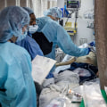When is a Ventilator Needed for Covid-19 Patients?